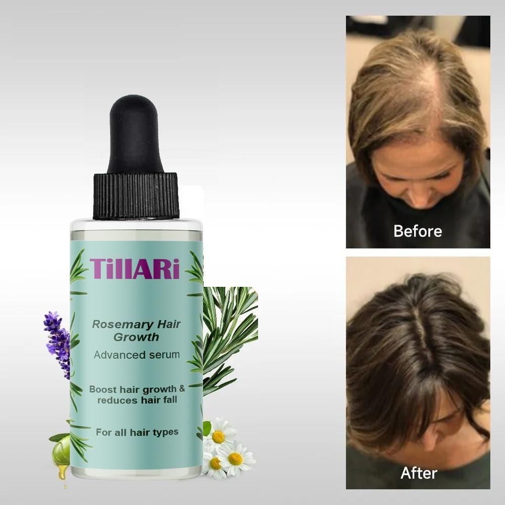 Tillari Rosemary Hair Growth Serum