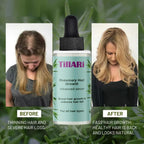 Tillari Rosemary Hair Growth Serum