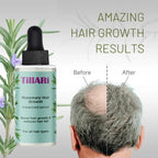 Tillari Rosemary Hair Growth Serum
